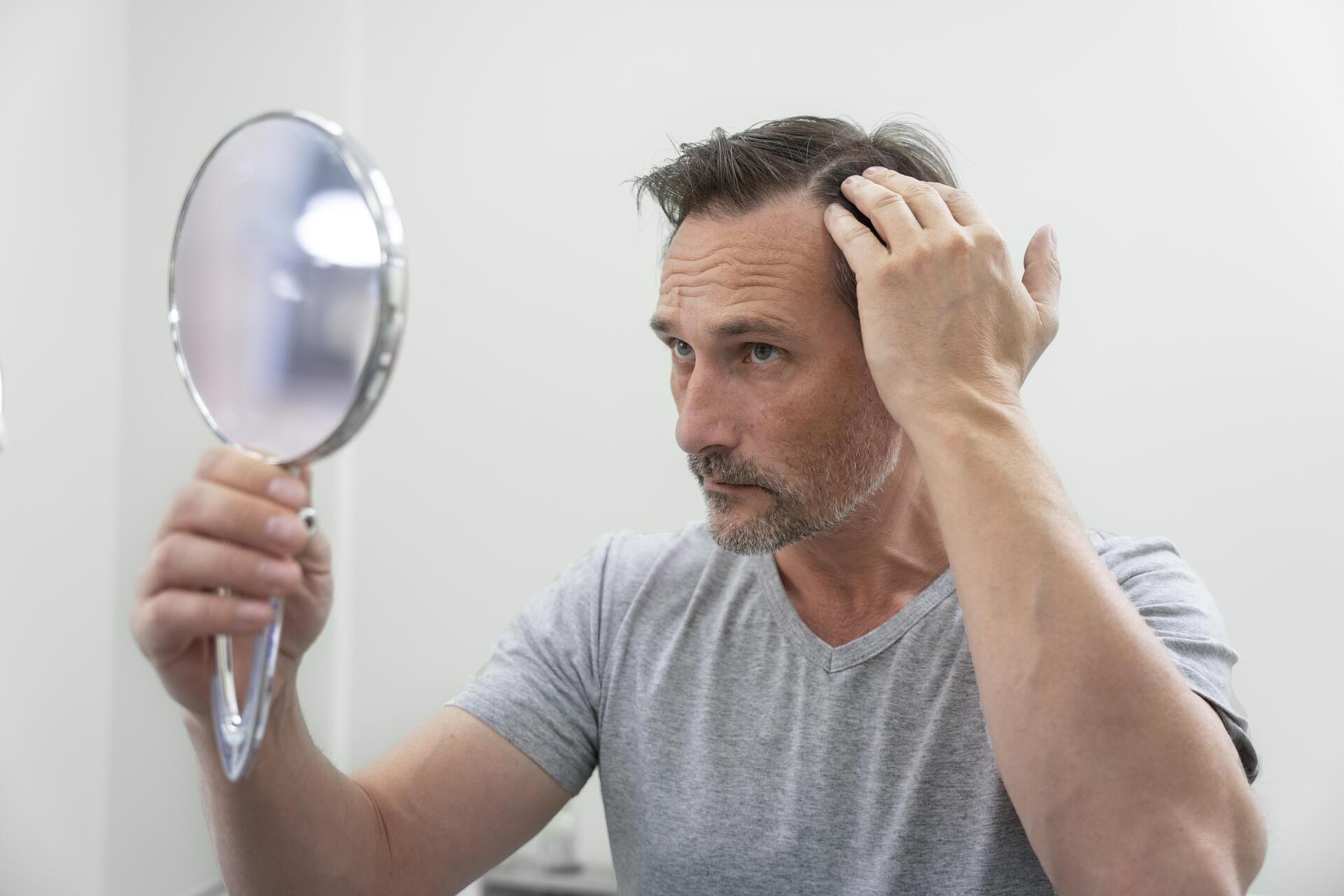 Homem preocupado analisando a queda de cabelo motivos e cuidados no espelho.