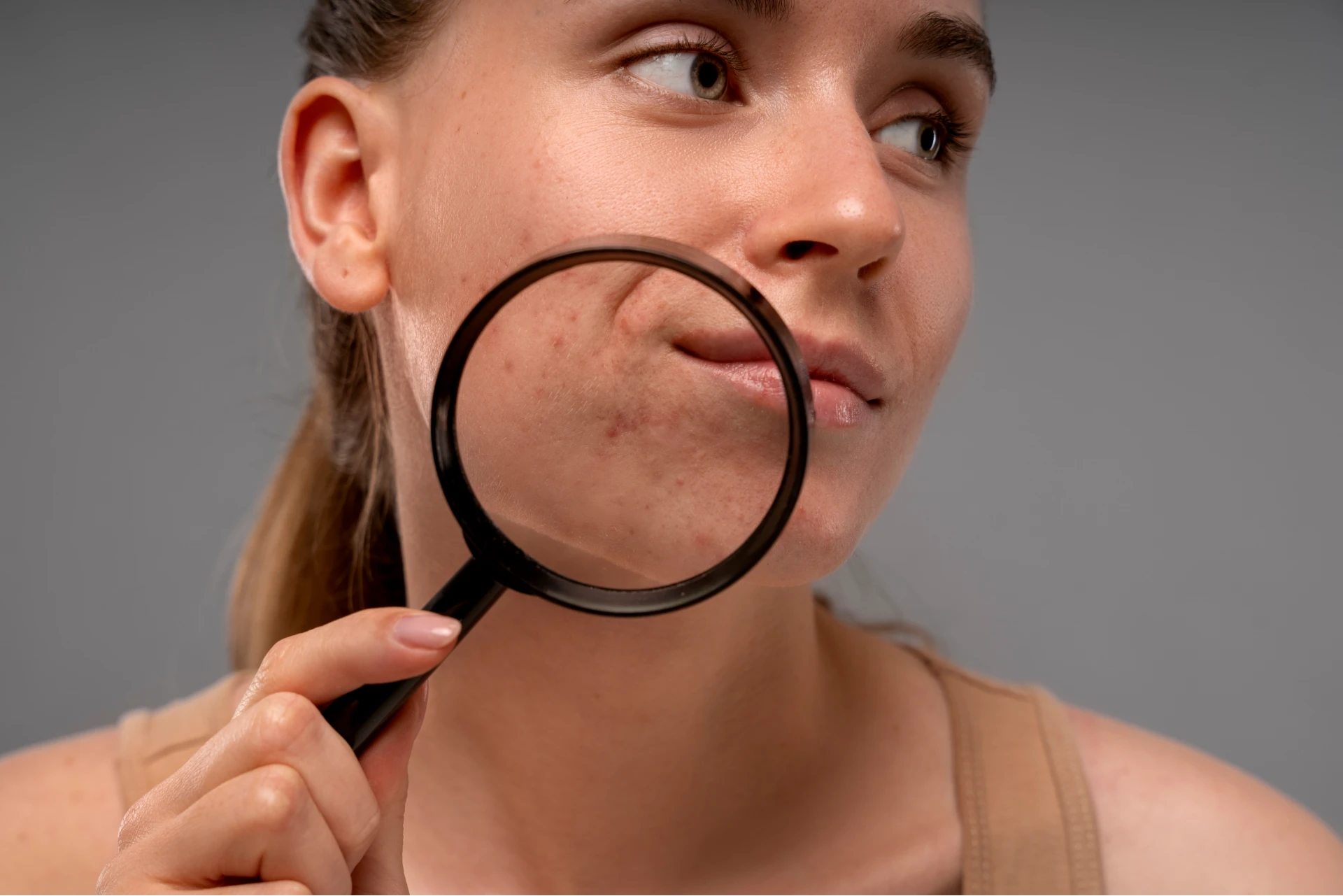 Mulher segurando lupa próximo ao rosto, mostrando manchas de melasma na pele.